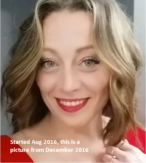 Invisalign - Heather's Story, Accent Dental