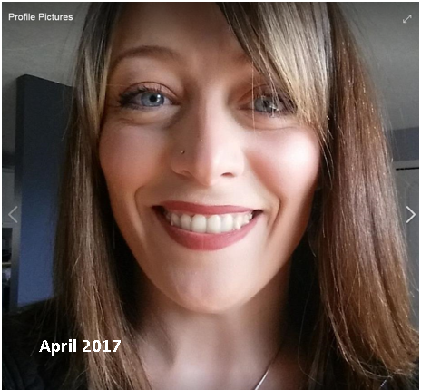 Invisalign - Heather's Story, Accent Dental