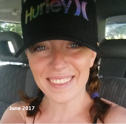 Invisalign - Heather's Story, Accent Dental