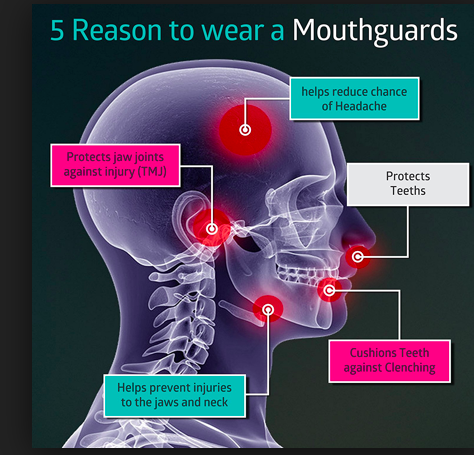 Teeth Whitening in Prince George - Accent Dental Features Services