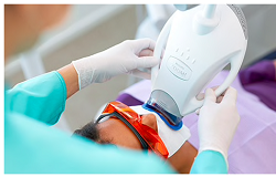 Teeth Whitening in Prince George - Accent Dental Features Services